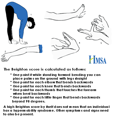 With thanks to the Hypermobility Syndrome Association